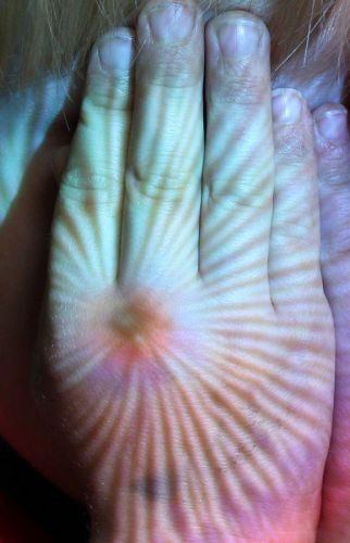 Hand